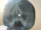 BEATLES SGT PEPPERS LONELY X-Ray USSR Record Roentgen Bones Ribs Music Vinyl