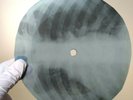BEATLES AND I LOVE HER X-Ray USSR Record Roentgen Bones Ribs Music Vinyl