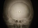 Doors - Queen of the Highway X-RAY OF THE USSR X-RAY BONE RECORDING