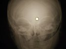 Beatles - Wait  X-RAY OF USSR X-RAY BONES RECORD