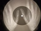 Ricky Nelson - Teenage Idol X-RAY OF THE USSR X-RAY BONES RECORD