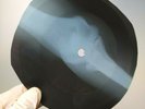 GLEN CAMPBELL IF YOU GO AWAY X-Ray USSR Record Roentgen Bones Ribs Music Vinyl