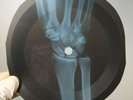 GLEN CAMPBELL BY THE TIME I GET X-Ray USSR Record Roentgen Ribs Music Vinyl