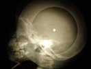 Beatles - Eleanor Rigby X-RAY OF THE USSR X-RAY BONE RECORD