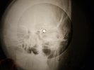 T.Rex - Metal Guru X-RAY OF THE USSR X-RAY BONES RECORDING