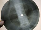 DOORS ALBINONIS ADAGIO G MINOR X-Ray USSR Record Roentgen Bones Ribs Music Vinyl
