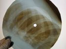 BEATLES WHILE MY GUITAR GENTLY X-Ray USSR Record Roentgen Bones Ribs Music Vinyl