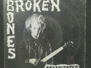 Broken Bones 