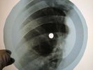 BOB DYLAN GIRL FROM THE NORTH X-Ray USSR Record Roentgen Bones Ribs Music Vinyl