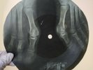 BOB DYLAN ITS HARD RAINS GONNA X-Ray USSR Record Roentgen Bones Ribs Music Vinyl