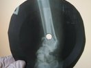 BEATLES CANT BUY ME LOVE X-Ray USSR Record Roentgen Bones Ribs Music Vinyl