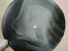 ROLLING STONES GIMME SHELTER X-Ray USSR Record Roentgen Bones Ribs Music Vinyl