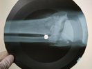 ELLA&BASSIE SATIN DOLL X-Ray USSR Record Roentgen Bones Ribs Music Vinyl