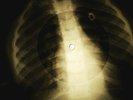 Beatles - Lovely Rita  X-RAY OF USSR X-RAY BONES RECORDING