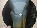 BEATLES SGT LONELY PEPPERS X-Ray USSR Record Roentgen Bones Ribs Music Vinyl