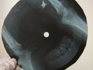 ROLLING STONES STREET FIGHTING X-Ray USSR Record Roentgen Bones Ribs Music Vinyl