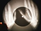 Beatles - The Fool on the Hill X-RAY OF THE USSR X-RAY BONES RECORDING
