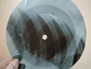 ARETHA FRANKLIN I NEVER LOVED X-Ray USSR Record Roentgen Bones Ribs Music Vinyl