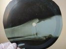 DAVID BOWIE MADE OF BOND STREE X-Ray USSR Record Roentgen Ribs Bones Music Vinyl