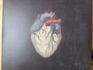 Alice In Chains Black Gives Way To Blue 2009 Clear Vinyl, 2X LP's N-Mint, Insert