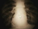Doors - Alabama Song X-RAY OF USSR X-RAY BONE RECORD