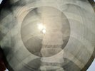 X-RAY, ROENTGEN, BONES RECORD, LP