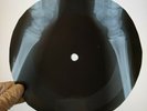DAVID BOWIE BLACK COUTRY ROCK X-Ray USSR Record Roentgen Bones Ribs Music Vinyl