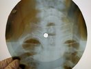ELVIS PRESLEY CANT HELP FALLIN X-Ray USSR Record Roentgen Bones Ribs Music Vinyl
