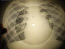 Beach Boys - In My Room X-RAY OF USSR X-RAY BONES RECORD