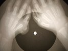 Johnny Cash - Big River X-RAY OF THE USSR X-RAY BONE RECORDING