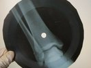 DUSTY SPRINGFIELD JUST A LITTLE XRay USSR Record Roentgen Bones Ribs Music Vinyl