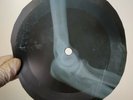 JOAN BAEZ SILVER DAGGER X-Ray USSR Record Roentgen Bones Ribs Music Vinyl