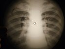 Doors - Break On Through X-RAY OF USSR X-RAY BONES RECORD