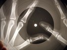 Simon & Garfunkel - Cecilia X-RAY OF THE USSR X-RAY BONES RECORD