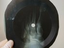 JAKIE WILSON HIGHER&HIGHER X-Ray USSR Record Roentgen Bones Ribs Music Vinyl