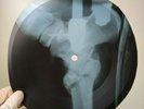 DAVID BOWIE ALL THE MADMAN X-Ray USSR Record Roentgen Bones Ribs Music Vinyl