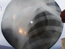 USSR GEORGIAN X-RAY ROENTGEN BONES  RECORD  UNIQUE ITEM 100% ORIGINAL