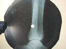 ELVIS PRESLEY TUTTI FRUTTI X-Ray USSR Record Roentgen Bones Ribs Music Vinyl
