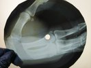 DAVID BOWIE ANCLE ARTHUR X-Ray USSR Record Roentgen Bones Ribs Music Vinyl