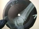 RICK NELSON YOUNG EMOTIONS X-Ray USSR Record Roentgen Bones Ribs Music Vinyl