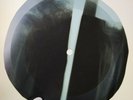 ROLLING STONES SATISFACTION X-Ray USSR Record Roentgen Bones Ribs Music Vinyl