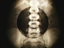 Who - My Generation X-RAY OF THE USSR X-RAY BONES RECORD