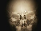 Rolling Stones - Heart of stone X-RAY OF THE USSR X-RAY BONES RECORDING