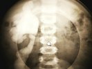 Who - Happy Jack  X-RAY OF USSR X-RAY BONES RECORD