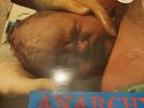 Chumbawamba  Anarchy Lp With Lmd Edition W/Poster