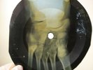 HOWLIN WOLF SMOKESTACK LIGHTNING X-Ray USSR Record Roentgen Bone Rib Music Vinyl