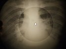 Bob Dylan - Like A Rolling Stone X-RAY OF USSR X-RAY BONE RECORDING