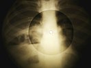 Louis Armstrong - La Vie En Rose X-RAY OF USSR X-RAY BONES RECORD