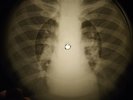Beatles - Glass Onion X-RAY OF THE USSR X-RAY BONES RECORDING
