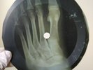 BEATLES RUN FOR YOUR LIFE X-Ray USSR Record Roentgen Bones Ribs Music Vinyl